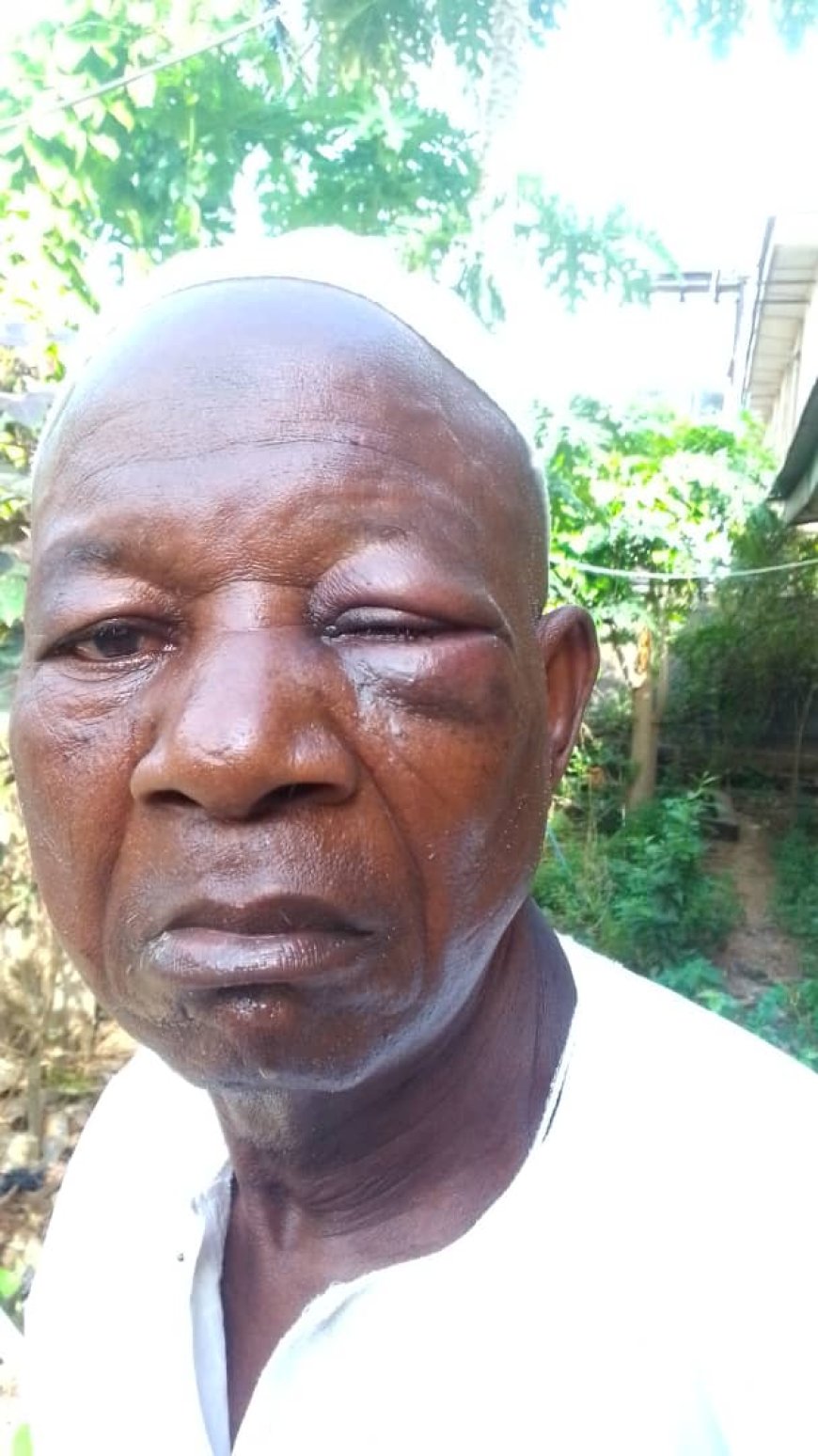 LG Chairmanship Aspirant Barters 79-yr old Landlord Over Compliance To Environmental Sanitation's Laws In Lagos ....Family Seeks Justice, Redress