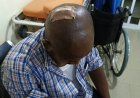 AEDC Officials Injured During Anti-Power Theft Operation at Dawaki Police Quarters