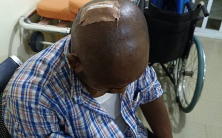 AEDC Officials Injured During Anti-Power Theft Operation at Dawaki Police Quarters