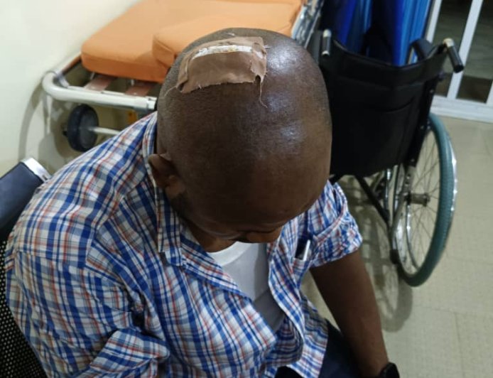 AEDC Officials Injured During Anti-Power Theft Operation at Dawaki Police Quarters